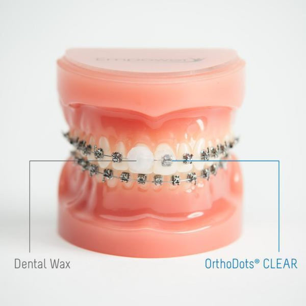 OrthoDots Silicone Compared To Dental Wax